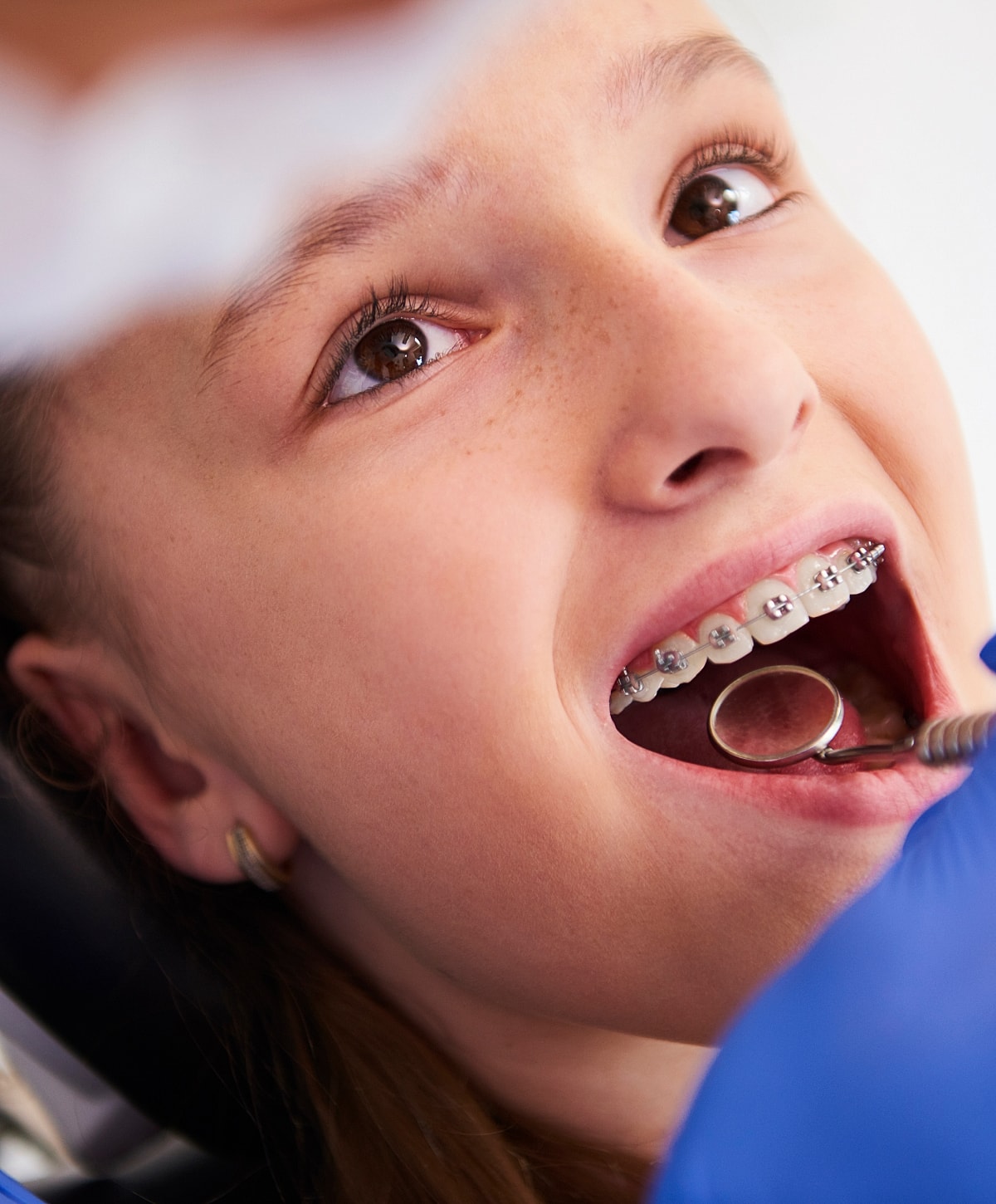 Child receiving dental care with braces.